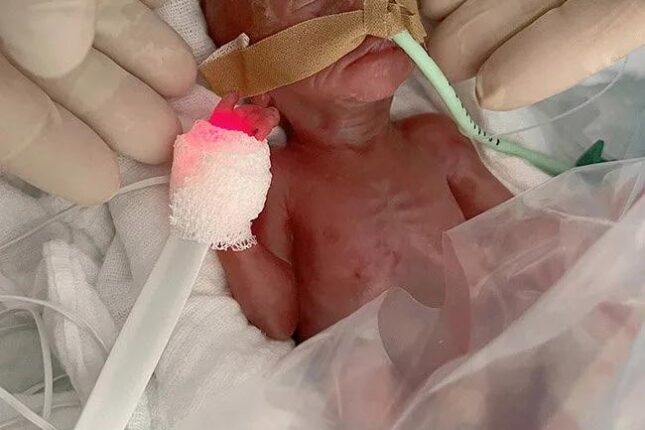 featured-image-709324