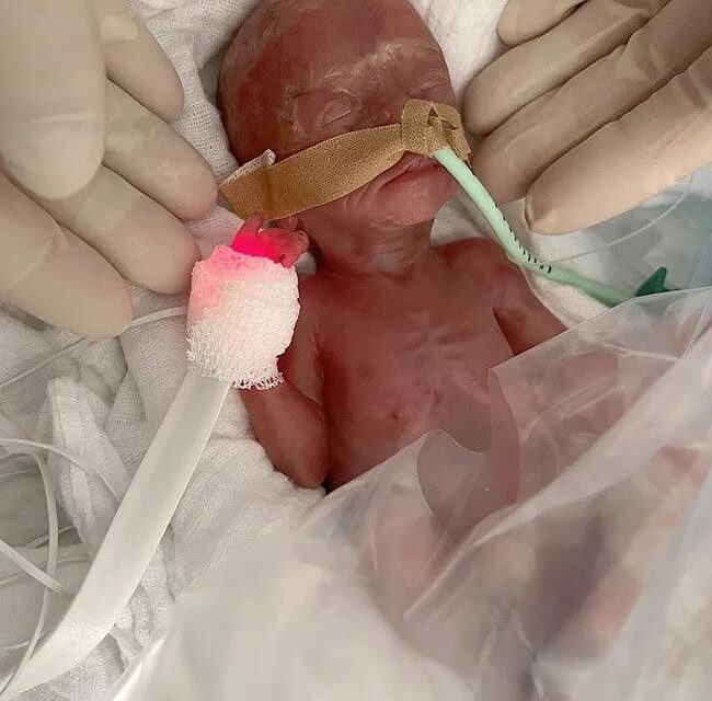 featured-image-709324