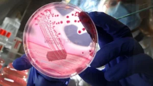 media-bu-gene-sahip-olanlar-dikkat-iki-ciddi-beyin-hastaligina-neden-oluyor-1597314_202511251504_1