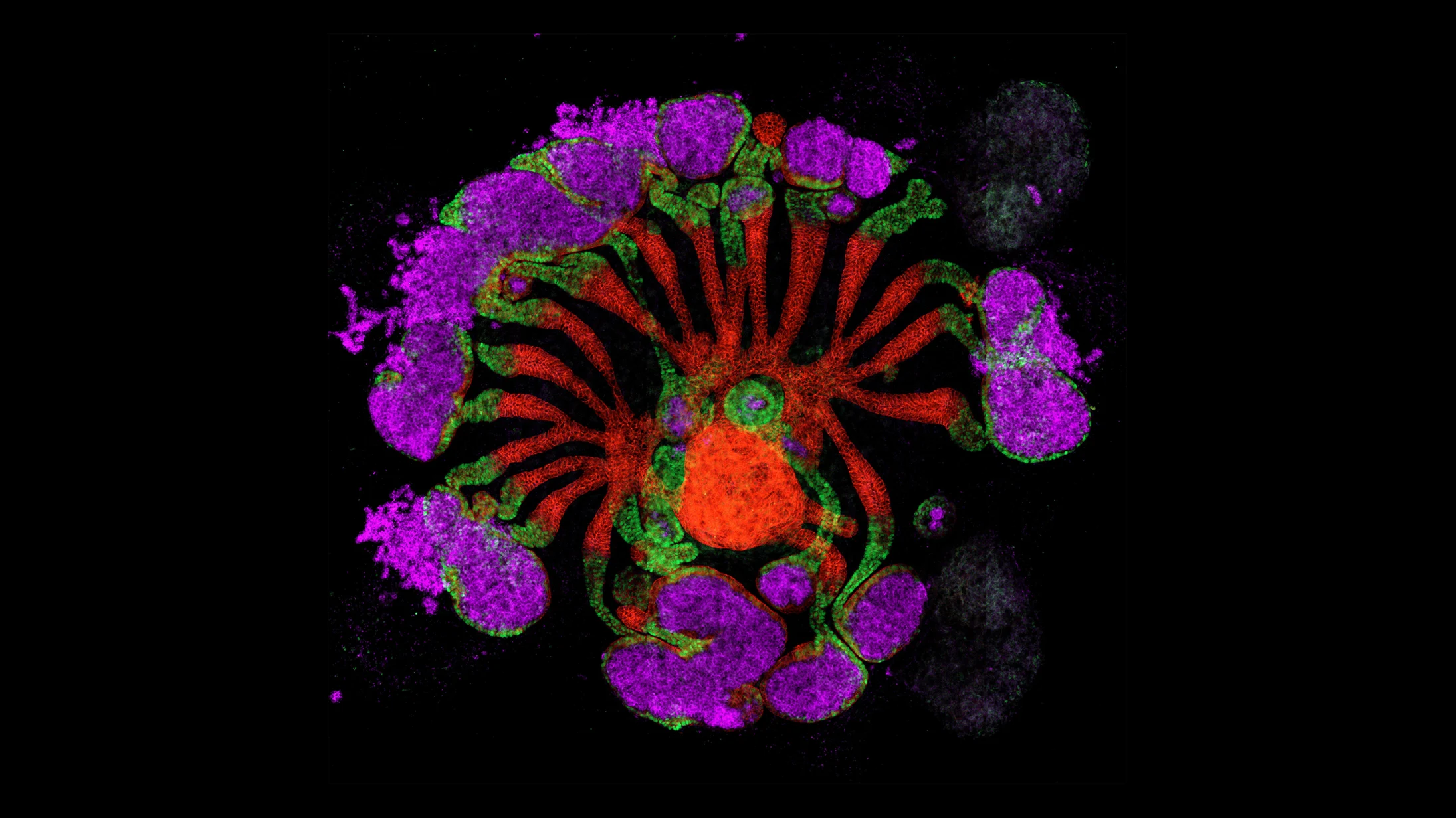 media-kidney-sh-h-extended-2-2191x1232