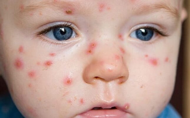 featured-image-723407