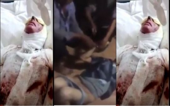 Azərbaycanda dəhşət – Ər arvadını “kislota”yla yandırdı – VİDEO